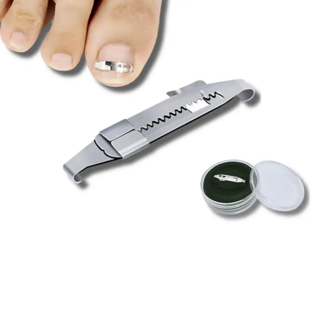 Инструменты для коррекции вросших ногтей на ногах Для педикюра Восстанавливают Вросший ноготь на пальце ноги Профессиональное средство для коррекции вросших ногтей на ногах